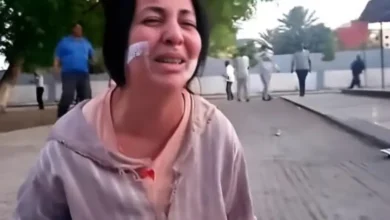 88 غرزة